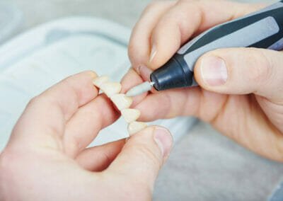 Prothésiste dentaire